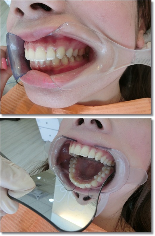 台中牙齒矯正診所名單-牙醫