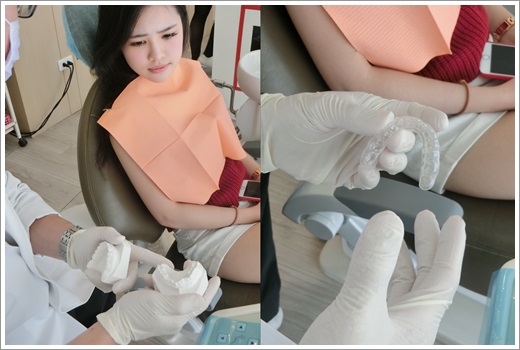 牙齒矯正專科-牙醫